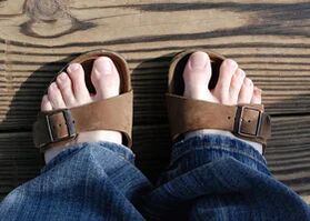 Gesunde Füße in Sandalen