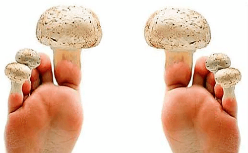 Nagelpilz