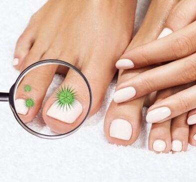 Nagelinfektion durch ein Lupenglas