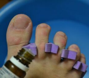 Vorbereitung zur Behandlung der Nägel mit antimykotischen Tropfen.