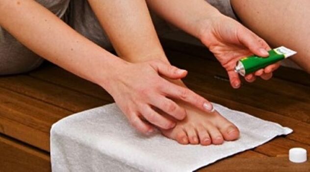 Behandlung von Zehennagelpilz mit Salbe